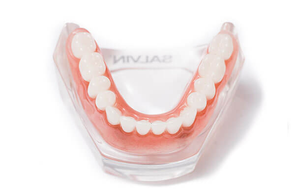 Mini dental implants in plastic model